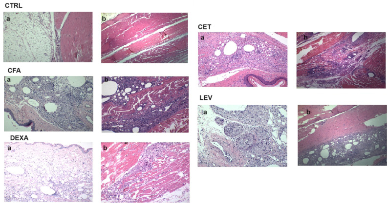 Histological section in the sagittal plane (10X/20X) of hind paw tissues in experimental animals. Representative micrographs of hematoxylin and eosin (H&E) stained sections of rat paws in each group on the 18th day of complete Freund’s adjuvant-induced arthritis with an enlargement ratio of 200 μm: (a) subcutaneous tissue; (b) muscle tissue.