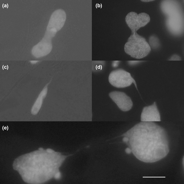 Nuclear structures of fixed cells after cannabidiol exposure. Solid nucleoplasmic bridges as a result of incomplete nuclear divisions (a, b). Filigree extrusion of nuclear material as a result of mechanical stress in the course of nuclear transport in cellular tubes (c). Filigree long-distance nucleoplasmic bridges of unknown genesis (d, e). Scale bar: 10 µm