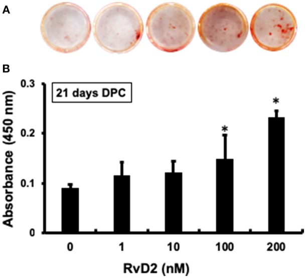 Alizarin red staining of DPCs stimulated with and without RvD2 (1-200 nM) for 21 days. (A) Obvious differences in the amounts of mineralization among the groups. (B) Quantitative analysis showed that 100 and 200 nM had significantly increased mineralized nodules as compared with control 0 nM (P < 0.05; Tukey-Kramer). *P < 0.05 indicates significant differences compared to the control, post hoc Tukey-Kramer test. Representative data of four independent samples.