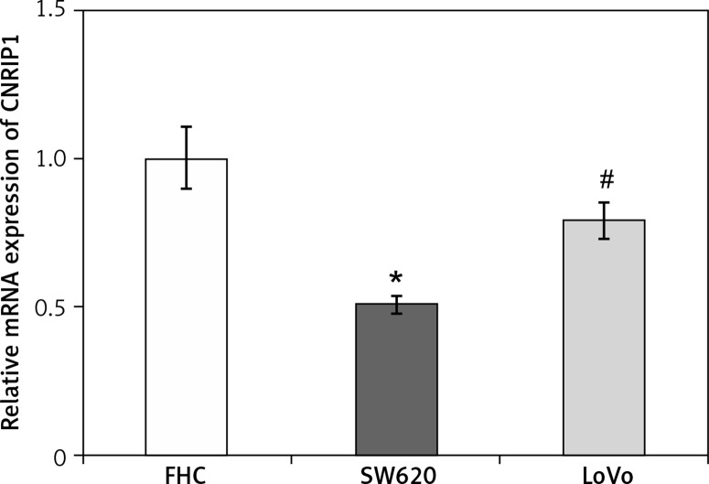 CNRIP1 mRNA expression in colon cells. CNRIP1 mRNA expression was significantly lower (p < 0.05) within the SW620 colon cancer cell line (0.51 ±0.03) than in the LoVo colon cancer (1.00 ±0.10) and FHC normal colon (0.79 ±0.06) cell lines*p < 0.05 (SW620 vs. FHC), #p < 0.05 (SW620 vs. LoVo).