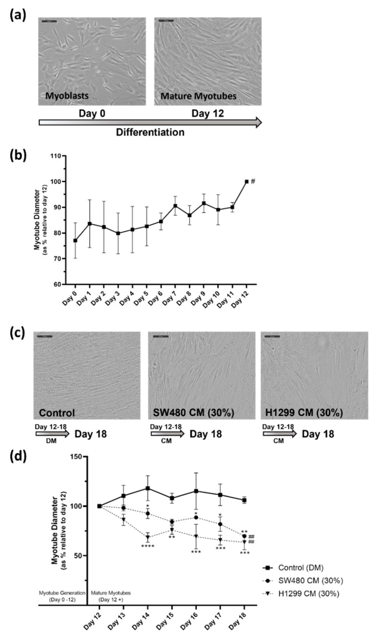 In vitro human skeletal muscle cancer cachexia cell model. (a,b) Differentiation process (12 days) of myoblasts to myotubes. (a) Representative image (20× magnification) of myoblasts (day 0) and mature differentiated myotubes (day 12). Scale bars set to 10 µm. (b) Graph demonstrates the increasing myotube diameter from day 0 to day 12, as the myoblasts differentiate to myotubes. Diameters were measured daily during the 12-day differentiation process and myotube diameter data are presented as % relative to diameter of mature myotubes at day 12. (c,d) At day 12, cancer CM was introduced to induce cachexia; media conditions were, 30% SW480 CM/70% DM, 30% H1299 CM/70% DM or 100% DM for control cells. Cells were monitored and myotube diameters were measured daily for 6 days. (c) Representative image (20× magnification) at day 18 for each condition: control (DM), 30% SW480 CM treated and 30% H1299 CM treated myotubes. Scale bars set to 10 µm. (d) Graph demonstrates the significant decrease in myotube diameter in the 30% SW480 and 30% H1299 CM cultured cells over the treatment period (# = p value ≤ 0.05, ## = p value ≤ 0.01) and compared to control myotubes cultured in DM, which maintained quite steady myotube diameters from day 12 to day 18 (* = p ≤ 0.05, ** = p ≤ 0.01, *** = p ≤ 0.001, ****= p ≤ 0.0001; compared to control). Data are presented as % relative to diameter of control (DM) mature myotubes at day 12. All data are mean ± SEM of at least n = 3.