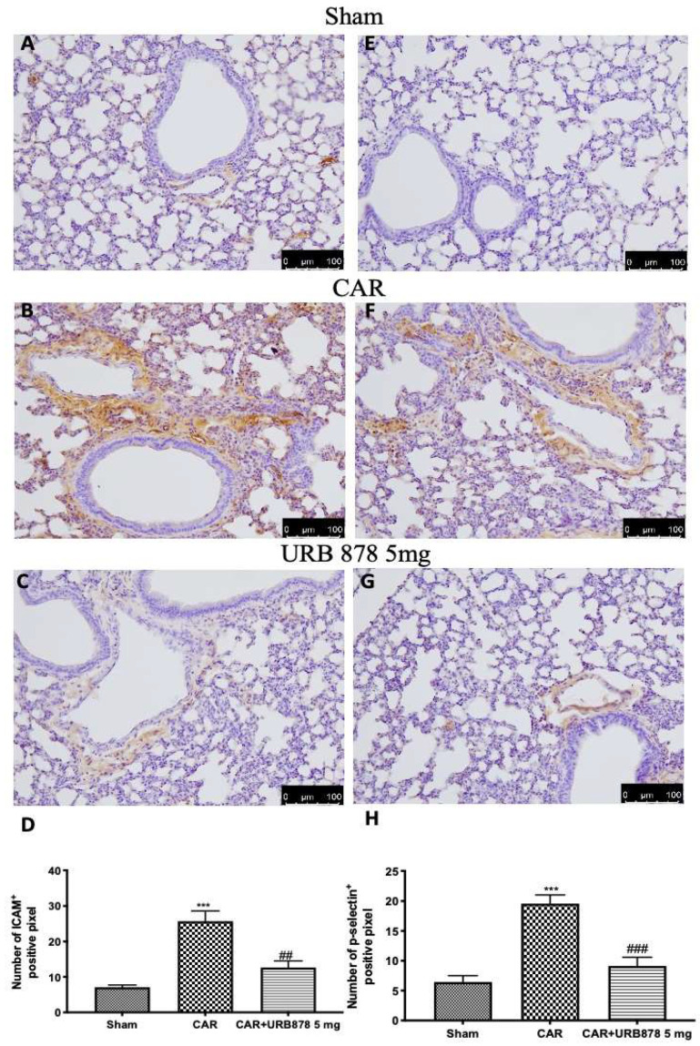 URB878 administration decreases ICAM and P-selectin expression. Sham (A); CAR (B); CAR+URB878 5 mg/kg (C); graphical analysis (D) for ICAM. Sham (E); CAR (F); CAR+URB878 5 mg/kg (G); graphical analysis (H) for P-selectin. Scale bar for (A–C) and (E–G) was 100 μm; Values are means ± SEM of 6 mice for all groups. Photos shown are representative of the results obtained. See manuscript for further details. *** p < 0.001 vs. sham; ## p < 0.01 vs. CAR; ### p < 0.001 vs. CAR.