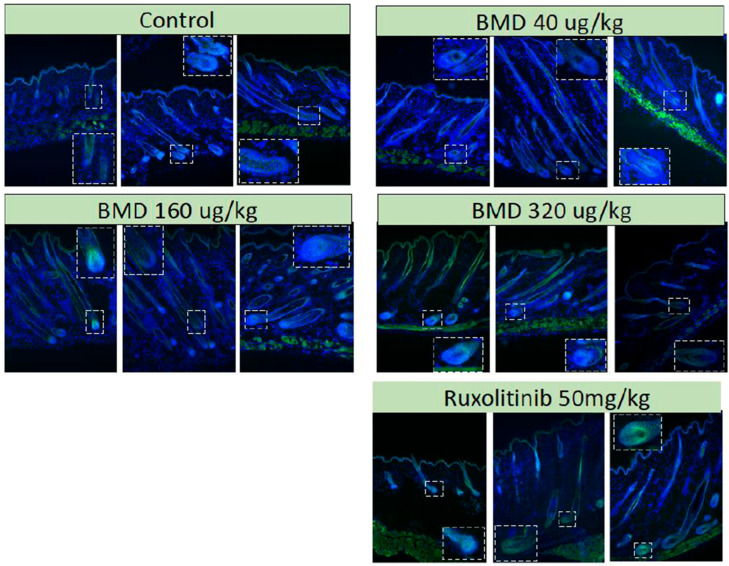 Beta-Catenin. C3H/HeJ mice were engrafted with full-thickness skin from mice with alopecia areata. After the development of alopecia, the mice were treated with either a single subcutaneous dose of BMD-1141 (at various doses) or daily oral ruxolinitib. After 8 weeks, the animals were sacrificed, and dorsal skin was harvested and sectioned at 7 µm thickness. The dorsal skin samples were sectioned (10 µm) and were incubated with rabbit anti-mouse β-catenin. Fluorescent imaging was conducted at ×10 magnification. The immunofluorescence for β-catenin is shown in green.