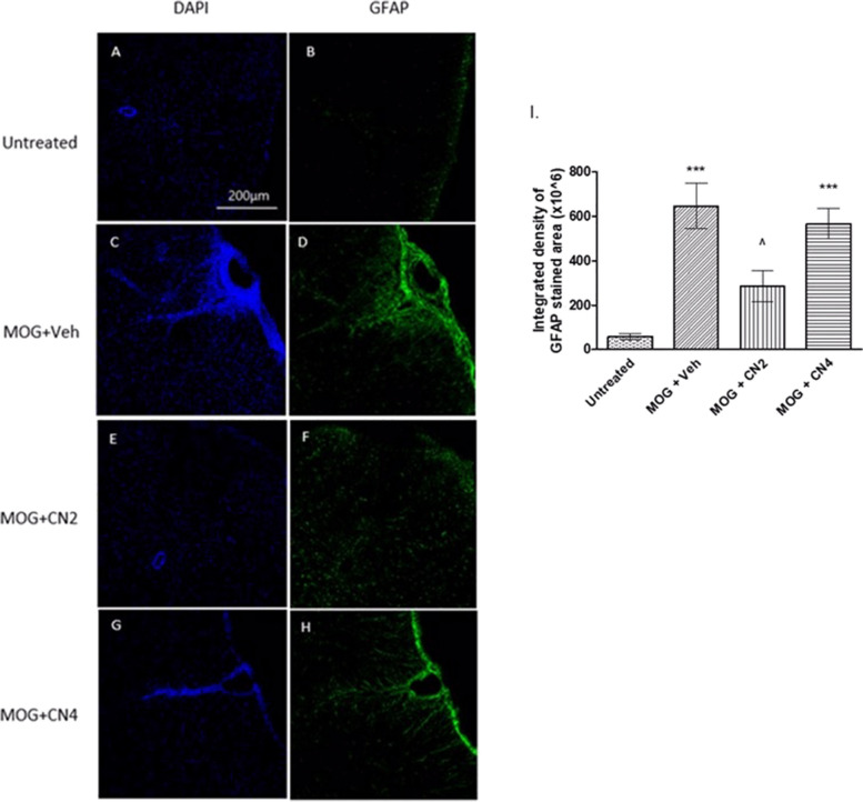 Astrocyte activation in the spinal cord of cannabis-treated mice. MOG35-55-given female C57BL/6 mice were treated with vehicle, CN2, or CN4. Spinal cords were removed and cut horizontally. Sections were stained using antibodies against GFAP (green), and the cell nuclei were stained with DAPI (blue) and examined using a confocal microscope (X20 magnification). The images (A-H) are representative images of 2 independent experiments, with 5 mice in each group. In I, the graphical result is presented as the mean ±SEM of the color intensity to the area, n ≥20. *** - p <0.001 vs. control, ^ p <0.05 vs. MOG