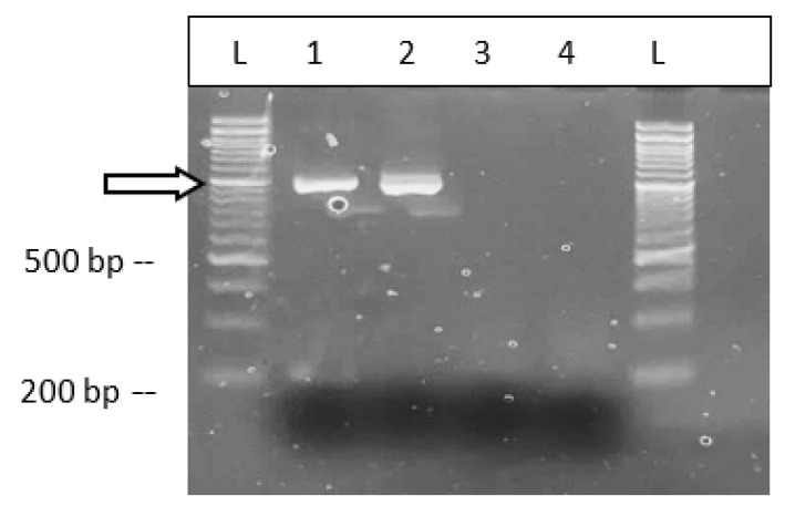 Confirmation of the presence of BCTV in samples of cannabis plants from indoor production. The BCTV-Wor strain was detected (lane 2). Lane 1 = BCTV universal primer; lane 3 = BCTV-Severe; lane 4 = BCTV-Colorado.