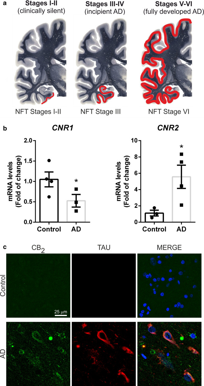 CB2 is increased in neurofibrillary tangle TAU positive neurons from AD patients. a Scheme of the different Braak stages of AD progression in the human brain: Stages I-II (transenthorinal), stages III-IV (limbic), and stages V-VI (neocortical) (Modified from http://www.thehumanbrain.info/ at the hippocampus level). b qRT-PCR determination of mRNA levels of CNR1 and CNR2. Both measures were normalized by TBP mRNA levels. n = 3–4 ± SEM. Asterisks denote significant differences *p < 0.05, comparing the AD patients with the control condition according to Student's t-test. c Double immunofluorescence staining of 15 μm-thick sections of hippocampal tissue from control (n = 4) and AD (n = 4) patients. Green, anti-CB2. Red, anti-TAU-HT7. Blue, DAPI