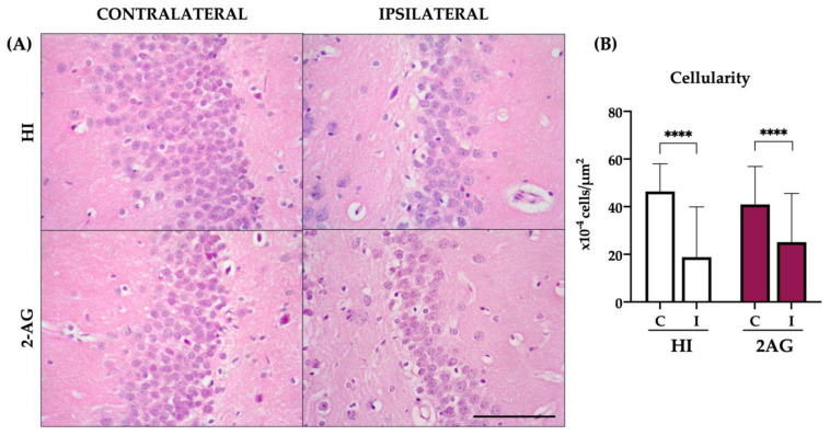 Non-treated and 2-AG-treated HI animals did not show differences in cellularity in the ipsilateral DG of the hippocampus at P90. (A) Representative microphotographs of the DG of the hippocampus of non-treated HI and 2-AG-treated animals. Images were taken at 40× magnification (Scale bar: 100 μm) (B) The ipsilateral DG of the non-treated HI group (HI) showed reduced cellularity compared to the contralateral DG (**** p < 0.0001). Similarly, the ipsilateral DG of the 2-AG treated group showed reduced cellularity compared to the contralateral DG (**** p < 0.0001). When comparing the ipsilateral DGs of the two experimental groups, no significant differences were found.