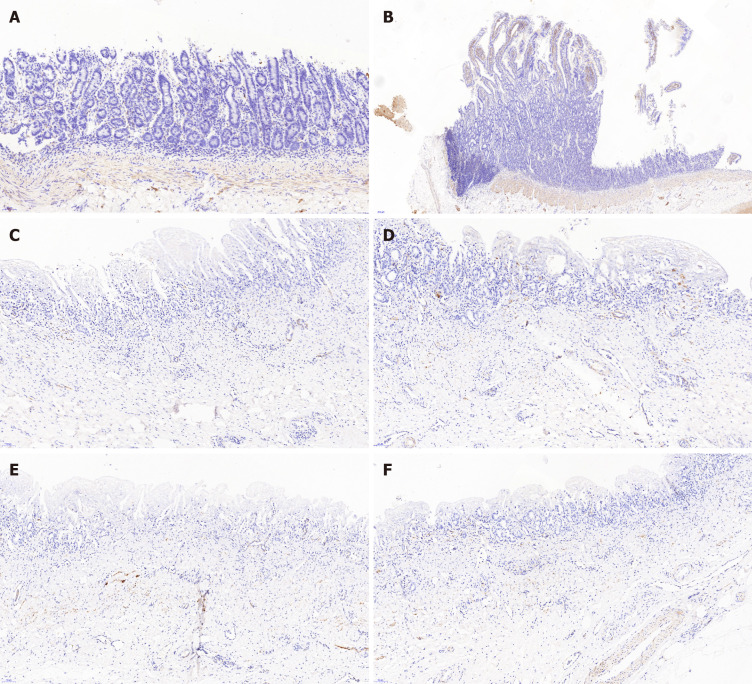 Desmin immunostaining. The desmin positive area confirmed the regeneration of smooth muscle. Meanwhile, the desmin positive area was significantly larger in group A than group B. A: Desmin immunostaining of the animal-derived artificial bile duct site in group A (magnification: 20 ×); B: Desmin immunostaining of duodenal papilla in group A (magnification: 20 ×); C and D: Desmin immunostaining of the animal-derived artificial bile duct site in group B (magnification: 20 ×); E and F: Desmin immunostaining of the distal normal bile duct in group B (magnification: 20 ×).