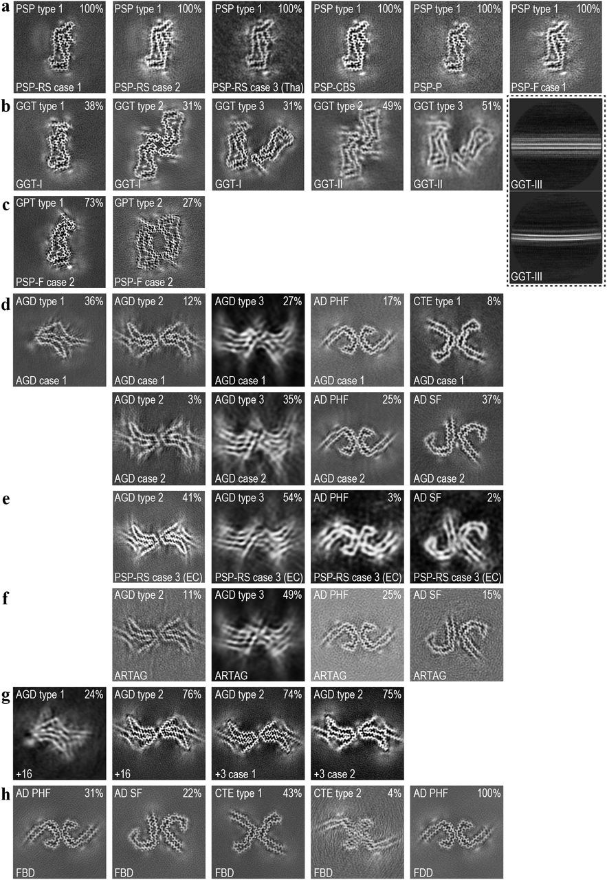 Cryo-EM reconstructionsFor each map, a sum of the reconstructed density for several central XY-slices, corresponding to ~4.7 Å, is shown. The disease cases are referenced at the bottom of each image; the filament type at the top left; and the percentage of that filament type among the tau filaments in the data set at the top right. The inset with dashed lines shows 2D class average images of GGT-III filaments without apparent twist.