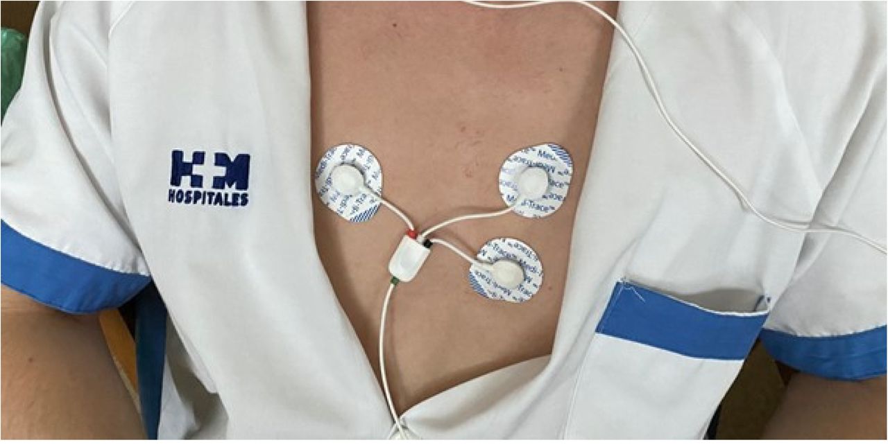 Electrode Placement for HRV Measurement: The image shows the placement of the Biosignalplux electrodes on a participant’s chest. Electrodes were placed according to the manufacturer’s guidelines to ensure accurate HRV data collection. The subject provided written consent for the use of this image in the publication
