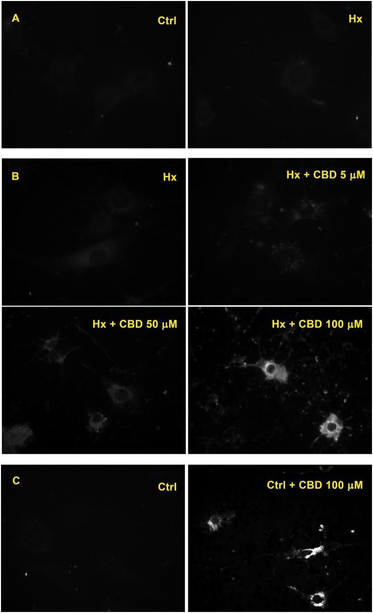 Effect of CBD on endothelial cells. (A) Fluorescence microscopy of H5V cells. (B) H5V cells exposed to hypoxia in the presence of CBD (5, 50, or 100 μM). (C) H5V cells, in normoxia, exposed to CBD (100 μM). All images were obtained with a magnification of 60×.