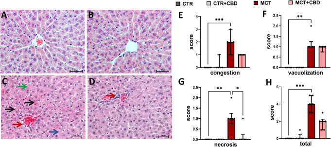 Representative liver sections stained with hematoxylin and eosin control (CTR) rats (A), CTR rats treated with cannabidiol (CBD) (B), rats with monocrotaline (MCT)-induced pulmonary hypertension (C), MCT rats treated with CBD (D). The black arrows indicate congestion, the blue arrow indicates the area of necrosis, the green arrow indicates vacuolization and the red arrows indicate the influx of inflammatory cells around the central vein. Magnification ×200 (Olympus BX43 (Olympus 114 Corp., Tokyo, Japan)); scale bar = 50 μm. Quantification of liver congestion (E), hepatocyte vacuolization (F), necrosis (G), and total changes in the scores above-mentioned liver pathologies (H) a according to the Suzuki’s classification (0–4 score). Data are presented as medians and interquartile ranges; n = 5–6 animals per group. The Kruskal-Wallis followed by post-hoc Dunn’s test. A significance level is set at p < 0.05