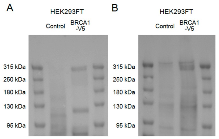 Western blot results to validate human BRCA1 detection by the anti-BRCA1 antibody used in this study, and to determine human full-length BRCA1 band pattern in our western blot protocol. Cell lysates of HEK293FT cells with or without transfection of pcDNA6.2-BRCA1-V5 plasmid were used. (A) A western blot using anti-V5 antibodies showed a ≈300 kDa band and some smaller molecular weight bands in cells transfected with the BRCA1-V5 plasmid. (B) A western blot using the anti-BRCA1 antibody used in this study showed the same ≈300 kDa band in cell samples transfected with the BRCA1-V5 plasmid.