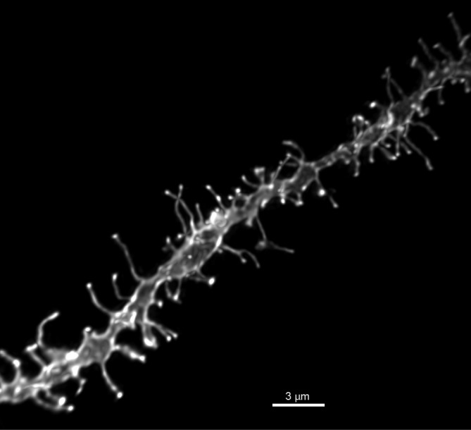 Representative image of DiI dendritic segment. High power (60×) reconstruction of a DiI labeled NAcSh MSN dendritic segment, scale bar 3 μm.
