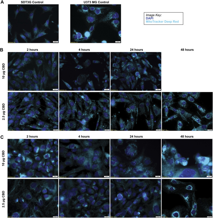 CBD causes morphological changes in mitochondria. (A) Untreated SDT3G and U373 MG cells demonstrate a fibrillar mitochondrial network. Following treatment with CBD, both SDT3G (B) and U373 MG (C) cells show dramatic changes in mitochondrial morphology within 2 hours of 10 μg/ml CBD treatment that is not observed at 2.5 μg/ml CBD. Nuclei are represented by dark blue and mitochondria are represented by cyan pseudo colors.