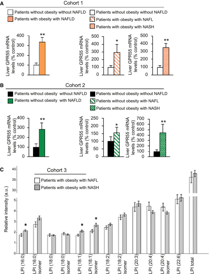 Hepatic GPR55 mRNA is up‐regulated in patients with NAFLD. GPR55 mRNA levels in the liver of (A) participants without obesity and without NAFLD (n = 11) or participants with obesity and NAFLD (n = 35) (cohort 1), either grouped or considering the NAFL (n = 8) and NASH (n = 27) stages in two different groups, and (B) patients without obesity and without (n = 18) or with (n = 21) NAFLD (cohort 2), either grouped or considering the NAFL (n = 13) and NASH (n = 8) stages in two different groups. (C) Serum levels of the different species of LPI in patients with NASH (n = 78) compared with patients with fatty liver without NASH (n = 31) (cohort 3). HPRT was used to normalize mRNA levels. Data are presented as mean ± SEM. Statistical differences are denoted by *P < 0.05 and **P < 0.01. Abbreviations: GPR 55, G protein–coupled receptor 55; HPRT, hypoxanthine‐guanine phosphoribosyltransferase; LPI, l‐α‐lysophosphatidylinositol; NAFL, nonalcoholic fatty liver; NAFLD, NAFL disease; NASH, nonalcoholic steatohepatitis.