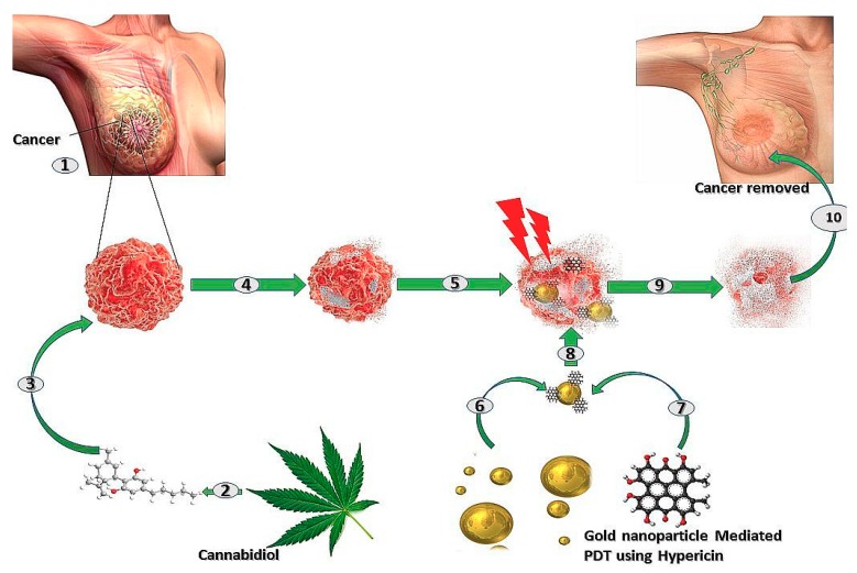 Combination therapy using cannabidiol and PDT to effectively treat breast cancer. (1) A lump of tumour in the right breast of a female. (2) Cannabis leaf can be used to extract Cannabidiol, (3) which, when injected in the body, binds to the Cannabidiol receptors on the tumour cells, (4) inducing cell death via activation of apoptosis. (5) Cells of the tumour start dying but Cannabidiol treatment alone is not efficient. (6) AuNPs and (7) Hypericin can be conjugated to form (8) a AuNP-Hypericin PS, which, when used in the PDT of the Cannabidiol treated tumour cells by exposure to light at a wavelength of 594 nm, (9) induces cytotoxicity of the cancer cells further enhancing cell death. (10) Ultimately, with combined therapy, there is maximum eradication of the tumour, restoring normal breast tissue.