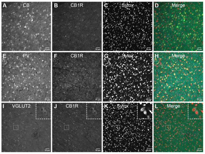 CB1R distribution in the inferior pulvinar. CB-positive (A–D) and PV-positive (E–H) neurons are shown in adjacent coronal sections of the vervet monkey pulvinar. In opposition to this diffuse and intense perinuclear staining pattern, CB1R-immunoreactivity closely matches the VGLUT2 annular-shaped terminal-like distribution (I–L, insets). The dashed squares in panels I–L indicate representative cells displayed at a higher magnification in the respective insets (3 × digital zoom). Nuclear counterstaining with Sytox orange is shown in the third column of each panel. CB: calbindin-D28k; CB1R: cannabinoid receptor type 1; PV: parvalbumin; VGLUT2: vesicular glutamate transporter 2. Scale bar = 50 µm.