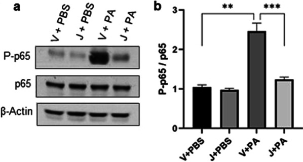 CB2R activation reduces NF-κB activation in PA pneumonia: C57BL/6 J WT mice received either vehicle (V) or JWH133 (J) and were exposed to PBS (control) or PA. NF-κB activation was assessed by measuring the protein levels of P-p65 and p65 in the lung. Representative immunoblot images are shown in panel (a) and densitometry data are presented in panel (b). n = 5, **p < 0.01***p < 0.001. Data are presented as mean ± SEM