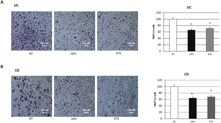 TRAP assays on (A) 7 patients with UC and (B) 7 patients with CD after 48 hours of exposure with JWH-133 (100 nM) and RTX (5 μM). The most representative images are displayed. TRAP (+) multinucleated (n ≥ 3) OCs, stained in purple, were counted through an AE2000 inverted microscope at 10x magnification, in at least 3 different wells for each individual sample. The percentage number of TRAP (+) cells respective to the total cell number for each sample is presented in the histogram as the mean ± SD. A Student t-test was used for the statistical analysis. *P ≤ .05 compared to NT. Abbreviations: CD, Crohn’s disease; NT, untreated control; OC, osteoclasts; RTX, Resiniferatoxin; SD, standard deviation; TRAP, tartrate-resistant acid phosphatase; UC, ulcerative colitis.