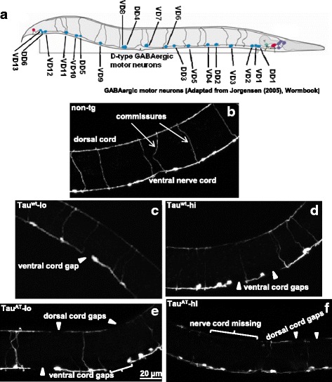 Mutant TauAT leads to substantial damage in GABAergic motor neurons. Punc-25::gfp reporter that labels GABAergic inhibitory neurons with GFP, was crossed with respective tau-transgenic worms to visualize these neurons. a Cartoon depicting the GABAergic inhibitory motor system in an adult worm. b-f depict representative maximum intensity projections (MIP) of day-1 old adults of the transgenes. For whole worm MIPs, see Additional file 11. Abnormalities seen as gaps in the GABAergic inhibitory neurons are highlighted by arrowheads. GABAergic neurons show normal connectivity in non-tg reporter worms, both dorsal and ventral nerve cords are intact (b). Expression of Tauwt produces dose dependent abnormalities in GABAergic neurons, with Tauwt -hi neurons (d) accumulating more damage than Tauwt -lo (c). However, mutant TauAT expression leads to severe abnormalities in the form of gaps in the dorsal and ventral nerve cords, both TauAT-lo (e) and TauAT-hi (f). One of the striking features of mutant TauAT worms is the absence of stretches of dorsal cord (bracketed areas), not found in non-tg worms or Tauwt worms. See Table 1 for detailed quantitative analysis