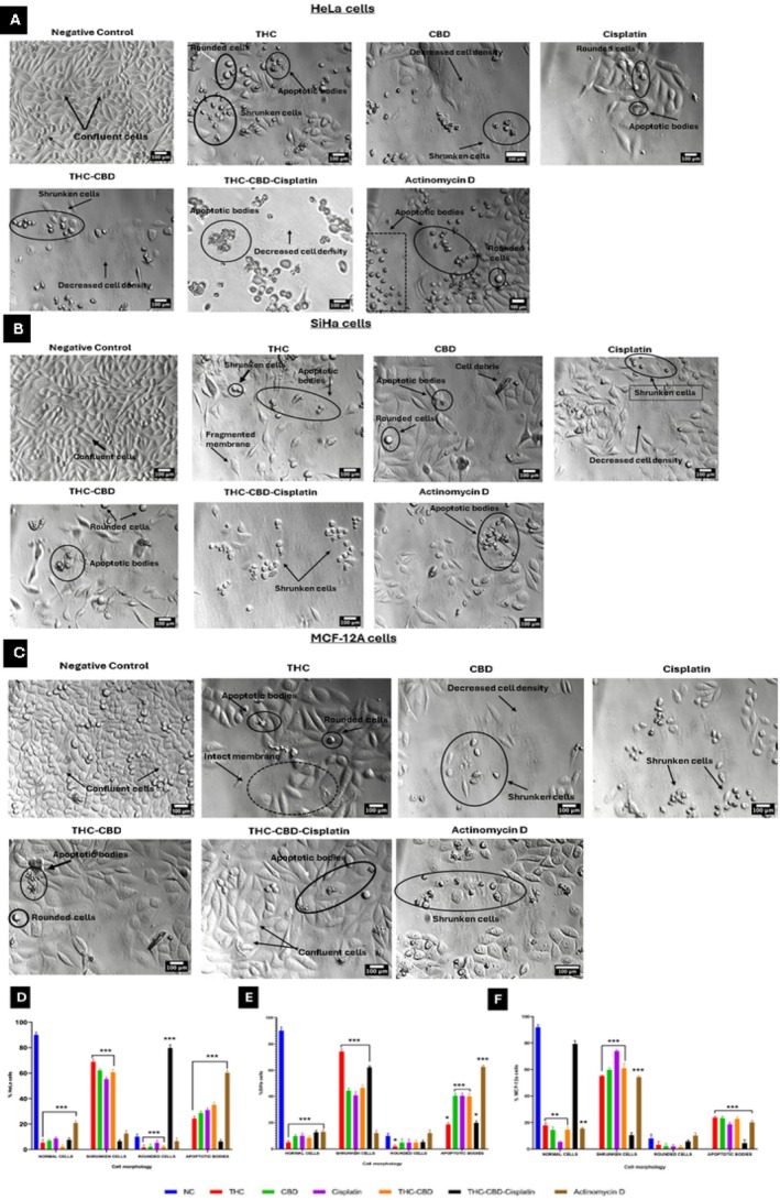 Micrographs of (A) HeLa, (B) SiHa, and (C) MCF‐12A cells after 72 h of treatment. Scale bar = 100 μm. Bar graphs (D–F) indicate quantification of morphological features in HeLa, SiHa and MCF‐12A cells, respectively. Standard deviation represented by T‐bars; **p < 0.05; **p < 0.01; and ***p < 0.001 indicates statistical difference between compounds and negative control (NC).