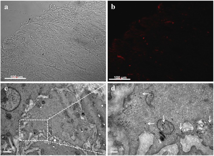 Distribution of nanoparticles in the gastric tissue. (a) and (b): Two-photo-laser scanning confocal microscopy images of intestinal tissue sections 7 days after tail vein injection of GNRs (Excitation: 780 nm, Emission: 601-657 nm). (c) TEM image of the gastric parietal cells; (d) Triangular silver nanoplates located in the gastric parietal cells (white arrows)