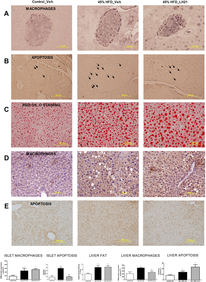 Effects of LH-21 in the islets of Langerhans and the liver. (A) Macrophage infiltration in the islets was assessed by immunohistochemistry with the specific marker F4/80. Quantification of immunostaining within islets revealed increased macrophage infiltration in 45% HFD mice, with no differences between vehicle- and LH-21-injected mice. The images are representative of islets from four mice each group and four different sections from each pancreas; one-way ANOVA and Bonferroni’s post-test, *p < 0.05 versus control. (B) Apoptosis in islet cells was assessed by a specific apoptosis kit. The number of apoptotic cells was increased in islets from 45% HFD-vehicle mice, while there was no increased apoptosis in islets from 45% HFD-LH-21 mice when compared to control mice. (C) Fat accumulation in the liver was studied by red-oil O staining of hepatic sections. Quantification of this specific marker revealed increased fatty content in the liver of 45% HFD mice, both vehicle- and LH-21-injected mice. (D) Macrophage infiltration in the liver was assessed by immunohistochemistry with the specific marker F4/80. These sections were counterstained with haematoxylin. Quantification of immunostaining in the liver revealed increased macrophage infiltration in 45% HFD-vehicle when compared to control-vehicle mice, but no increase was detected in 45% HFD-LH-21 mice. (E) Apoptosis in the liver was assessed by a specific apoptosis kit. The number of apoptotic cells was increased in the livers of both 45% HFD-vehicle and 45% HFD-LH-21 mice when compared to control-vehicle mice. (A,B) The images are representative of islets from four mice in each group and four different sections from each pancreas; one-way ANOVA and Bonferroni’s post-test, ***p < 0.001 versus control, ###p < 0.001 versus 45% HFD-vehicle. (C-E) The images are representative of livers from four mice in each group and four different sections from each liver; one-way ANOVA and Bonferroni’s post-test, *p < 0.05, **p < 0.01 versus control-vehicle, #p < 0.05 versus 45% HFD-vehicle.