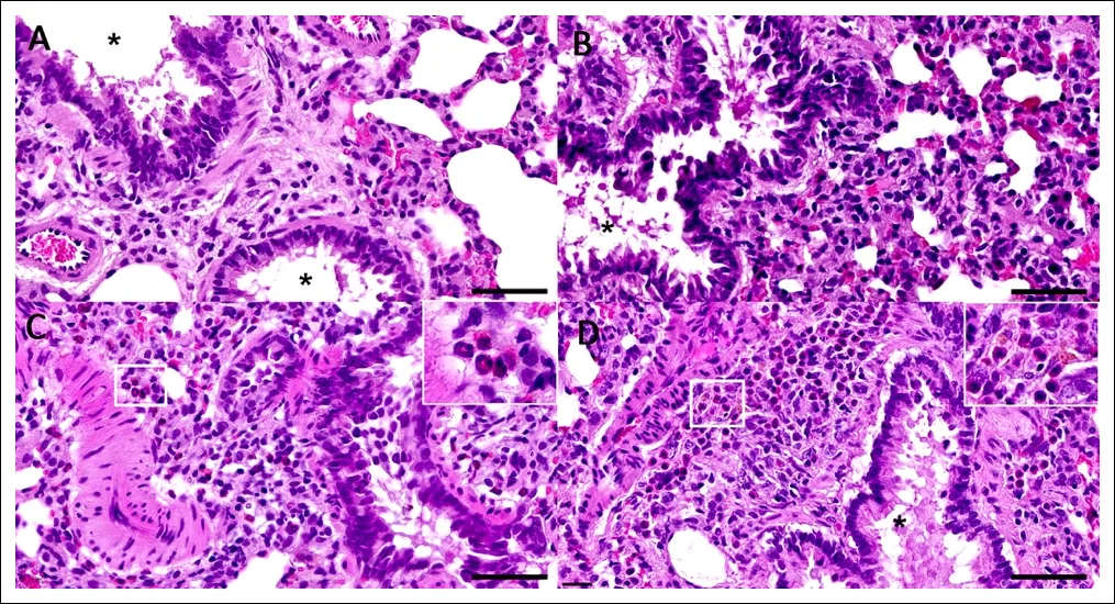 Histopathological changes in rat lungs following experimental cannabidiol vapor inhalation at 15 days (A), 30 days (B), 60 days (C), and 90 days (D). (A) Mild-to-moderate thickening of the alveolar septa with infiltration of foamy macrophages. (B) Hypercellularity becomes more pronounced, with increased numbers of foamy macrophages within the pulmonary interstitium. (C) Prominent inflammatory cell infiltration, including numerous eosinophils surrounding pulmonary vessels (inset). (D) Progressive accumulation of foamy macrophages and eosinophils around pulmonary vessels, accompanied by hemosiderin-laden macrophages. Hematoxylin and eosin stain. Asterisks indicate bronchi. Scale bars = 50 μm.