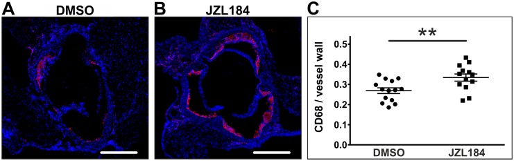 Quantification of CD68-positive macrophages and monocytes.Frozen sections through the aortic sinus of both DMSO-treated control mice and JZL184-treated mice with elevated 2-AG levels were stained for CD68 to visualize macrophages and monocytes (A, B). Positively stained areas were divided by the area of the vessel wall to obtain relative vessel infiltration (C). Data are presented as mean ± standard error of the mean; n = 13–14; **, p < 0.01, assessed by student’s t-test. Scale bar, 500 μm. DMSO, dimethyl sulfoxide; JZL184, inhibitor of monoacylglycerol lipase.