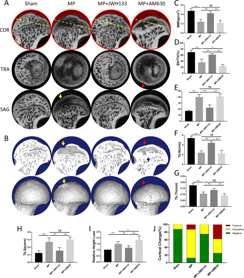 Activation of CB2 attenuate GC-induced bone destruction and maintain femoral-head morphology in GC-induced ONFH rat model.A coronal, sagittal, and transverse Micro-CT images. B Surface and profile view of femoral heads. Red arrows: cortical fracture; yellow arrows: cortical disruption; blue arrows: compensatory sclerosis. C BMD (g/cm3). D BV/TV (%). E BS/BV (1/mm). F Tb.N (1/mm). G Tb.Th (mm). H Tb.Sp (mm), and I Relative height loss. J Cortical changes (n = 10 per group, data are shown as mean ± SD, *p < 0.05; **p < 0.01; ns, not significant).