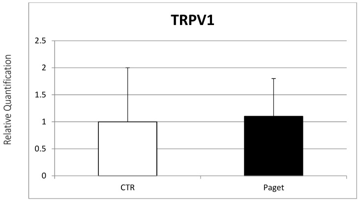 Comparison between TRPV1 mRNA expression evaluated with RT-PCR from 2 OCs of subjects with PDB and 2 healthy controls. Results were normalized for the housekeeping gene β-Actin and were showed as mean ± SD of three independent experiments on each individual sample.