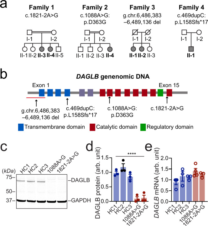 Identification of homozygous DAGLB mutations in affected families.a Pedigrees are shown for the four affected families. A double bar represents parental consanguinity. Slash indicates deceased individuals. Males are represented by squares, females by circles, and affected individuals by shading. b Schematic view of DAGLB gene structure and encoded protein domains. The four transmembrane segments are shown in blue, and the catalytic domain in maroon. Within the catalytic domain, a regulatory loop is colored in green. Variant sites are indicated by arrows. c–e Representative western blot (c) and quantification of DAGLB protein (d) and mRNA (e) levels in fibroblasts derived from Family 1 II-3, Family 2 II-4 and three age-matched HCs. N = 3-4 independent fibroblast cultures. Data were normalized to glyceraldehyde 3-phosphate dehydrogenase (GAPDH) protein or mRNA levels as appropriate and represent mean ± SEM. One-way ANOVA, F = 33.09, ****p < 0.0001.
