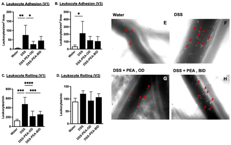 PEA treatment reduces DSS-induced increased in leukocyte recruitment in mouse colons. (A) Adherent and (C) non-adherent leukocytes and (E–H) representative images of leukocytes (red triangles) in collecting venules (V1) of the colon in mice given either water or DSS 4% and treated with PEA, OD or BID. (B) Adherent and (D) non-adherent leukocytes from post-capillary venules (V3) from mice given either water or DSS 4% or DSS 4% mice treated with PEA, OD or BID. Data are represented as means ± SEMs; N = 8–10. * p < 0.05, ** p < 0.01, *** p < 0.001, and **** p < 0.0001 using one-way ANOVA with a post hoc analysis.