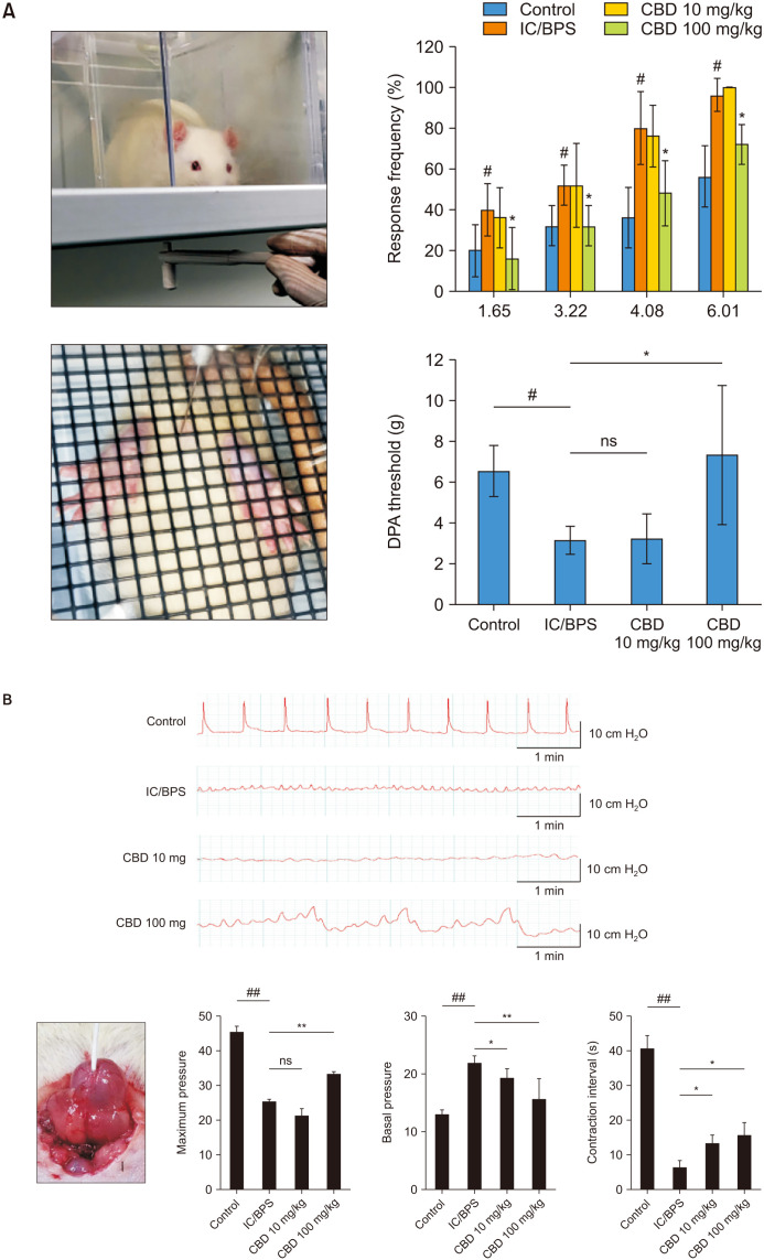 (A) Representative images and quantitative results of the von Frey filament test for nociceptive responses and the DPA test for nociception in each experimental group. (B) Representative cystometry (CMG) images and bladder parameters, including maximum pressure, base pressure, and contraction interval, are shown. Data are expressed as mean±standard error (n=5). DPA: dynamic plantar aesthesiometer, IC/BPS: interstitial cystitis/bladder pain syndrome, CBD: cannabidiol. *p<0.05, **p<0.01 compared with the IC/BPS group; #p<0.05, ##p<0.01 compared with the control group.