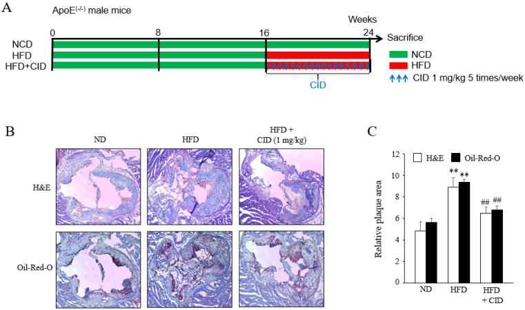 Effects of GPR55 blockage on atherosclerotic plaque formation in vivo. (A) High fat-diet (HFD)-induced atherosclerosis protocol. Sixteen-week aged ApoE−/− mice were followed up for 8 weeks under normal chow diet (ND) or were fed with an HFD from 16 weeks to 24 weeks (HFD). Another group of mice, that is, the HFD plus CID16020046 group, was intraperitoneally treated with 1 mg/kg CID16020046, five times per week during HFD feeding before euthanasia. (B) Images of H&E and oil red O staining in cross-sections of the aortic sinuses from the ND, HFD, or HFD plus CID16020046 groups. Representative images from five or six independent mice are shown. (C) Quantitative data are presented as the means ± SEM of five or six independent mice. ** p < 0.01 compared with an ND, ## p < 0.01 compared with an HFD.
