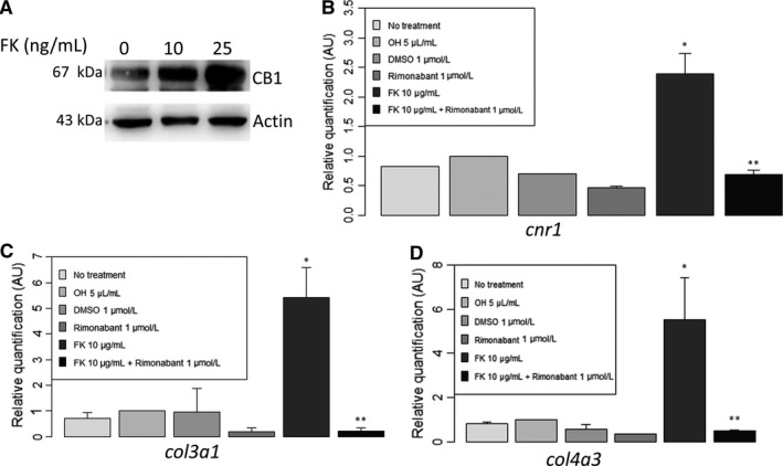 In vitro model of tacrolimus‐mediated fibrogenesis: tacrolimus increased CB1 expression, cnr1 (encoding for CB1) expression as well as col3a1 (encoding for Collagen 3) and col4a3 (encoding for Collagen 4). Cnr1, col3a1 and col4a3 expression were significantly blunted by rimonabant, a CB1 antagonist. A, Tacrolimus significantly increased CB1 expression (Western blot, n = 4, 3.5 ± 3.4 vs 1.0 ± 0, relative quantification after normalization, P = .03) in human proximal tubule epithelial cells (HK2) after 48 h of daily treatment with tacrolimus (FK) (10 ng/mL and 25 ng/mL). B, Expression of cnr1 mRNA evaluated by RT‐qPCR after 24 h of treatment (n = 4 for each group). *P < .05 vs ethanol 5 µL/mL. **P < 0.05 vs FK 10 µg/mL. C, Expression of col3a1 mRNA evaluated by RT‐qPCR after 24 h of treatment (n = 4 for each group). *P < 0.05 vs ethanol 5 µL/mL. **P < .05 vs FK 10 µg/mL. D, Expression of col4a3 mRNA evaluated by RT‐qPCR after 24 h of treatment (n = 4 for each group). *P < .05 vs ethanol 5 µL/mL. **P < .05 vs FK 10 µg/mL