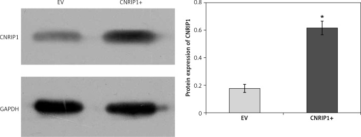 CNRIP1 protein expression levels within colon cancer cell lines treated with a CNRIP1-overexpression plasmid. The level of CNRIP1 protein expression was significantly higher (p < 0.05) within cells transfected with a CNRIP1-overexpression plasmid (0.615 ±0.05) relative to control SW620 cells within the EV group (0.177 ±0.03)*p < 0.05 (CNRIP1+ vs. EV).