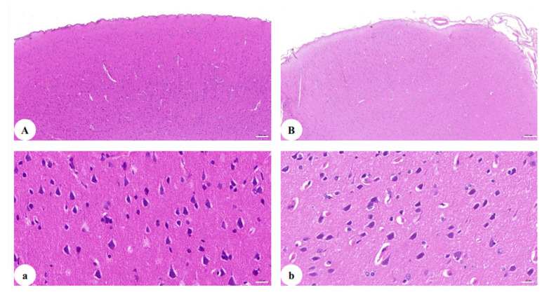 H&E staining of the cerebral cortex: (A) section of the cerebral cortex of healthy monkey (50×); (B) section of the cerebral cortex of the SHIVKU-1-infected monkey brain (50×); (a) section of the cerebral cortex of healthy monkey (400×); (b) section of the cerebral cortex of the SHIVKU-1-infected monkey brain (400×).