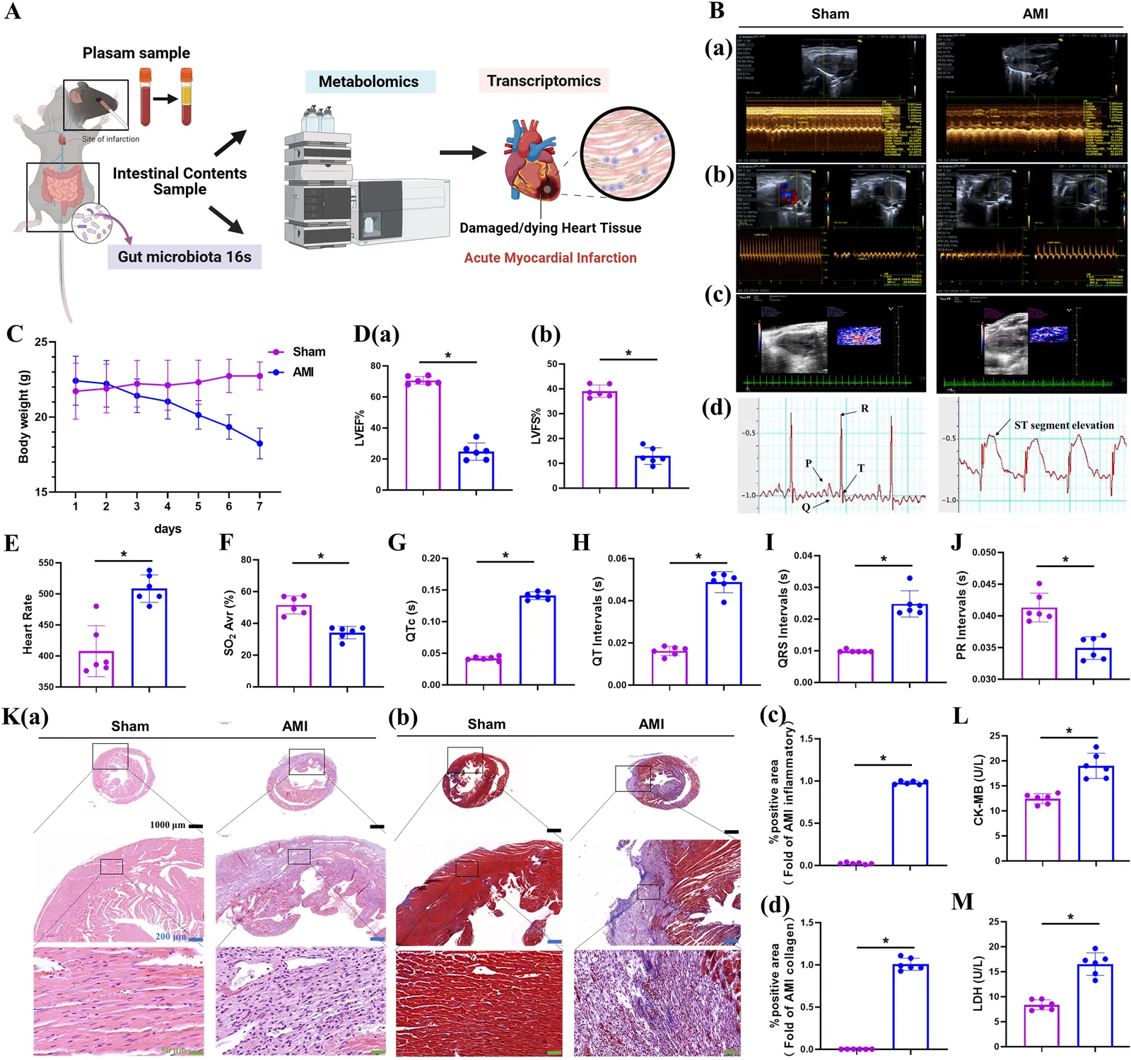 Panel of scientific figures and data visualizations illustrating an experimental workflow for acute myocardial infarction (AMI) in mice. Panel A shows a schematic involving plasma, intestinal, and tissue sampling for metabolomics, transcriptomics, and microbiota analysis. Panel B contains ultrasound and ECG results comparing sham and AMI groups, showing abnormal heart rhythms and segment elevation in AMI. Panel C plots declining body weight in AMI mice versus controls. Panels D to J present bar graphs of various cardiac function parameters, with significant differences marked. Panel K displays histological images showing tissue damage and inflammation in AMI. Panels L and M show elevated serum markers (CK-MB, LDH) in AMI mice.