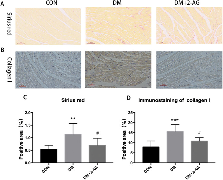 2-AG inhibits myocardial fibrosis and collagen deposition in diabetic mice A. Representation of the Sirius red-stained heart. Scale bar, 60 μm. B. A representative image of collagen I immunohistochemical staining. Scale bar, 60 μm. C. Statistical graph of the positive area of Sirius red staining. D. Statistical graph of immunohistochemical protein expression. **P < 0.01, ***P < 0.001 compared with the CON group; #P < 0.05 compared to the DM group. n = 7