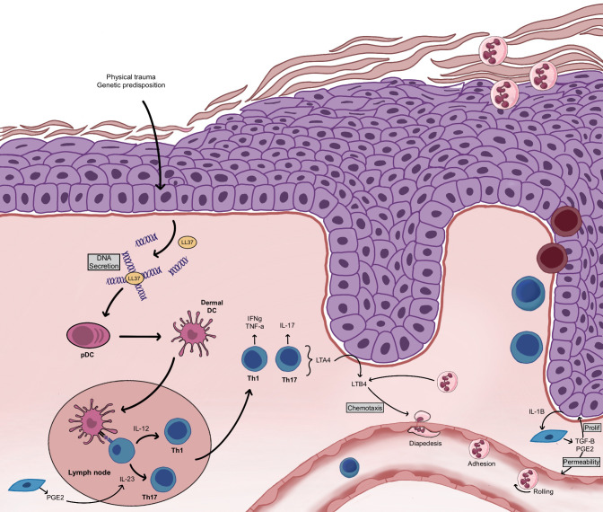 Establishment of the psoriatic plaque. Following a physical trauma or triggered by genetic predispositions, keratinocytes secrete their own DNA. The pDC become activated and stimulate the dermal DC. Dermal DC present their antigen to T cells, which induces T cell recruitment, CD4+ T cell polarization toward a Th1 and Th17 phenotype and CD8+ T cell migration to the epidermis. Keratinocytes enter into hyperproliferation. Neutrophils are recruited and migrate to the stratum corneum. LTB4 contributes to neutrophil chemotaxis while PGE2 contributes to keratinocyte proliferation.