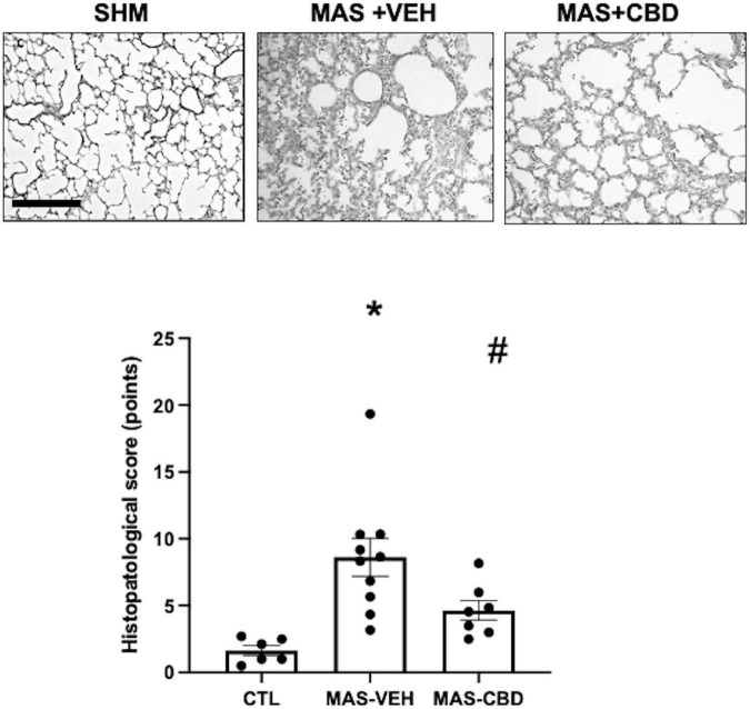 Histopathological score as assessed after haematoxylin-eosin staining in lung tissue from ventilated control (CTL, n = 6) animals and piglets submitted to meconium aspiration (MAS) and then treated with i.v. vehicle (VEH, n = 10) or CBD (n = 6). Top: Representative light microphotographs. In lung from MAS-VEH animals there is interstitial leukocyte infiltration, haemorrhage and interstitial oedema, which was reduced by CBD treatment. Original magnification x200, bar: 200 μm. Bottom: quantification of lung damage by a severity score. Results are expressed as mean ± SEM of 6–10 animals. (*) p < 0.05 vs. CTL, (#) p < 0.05 vs. MAS + VEH by one-way ANOVA with Holm-Šidák’s post-hoc test for multiple comparisons.