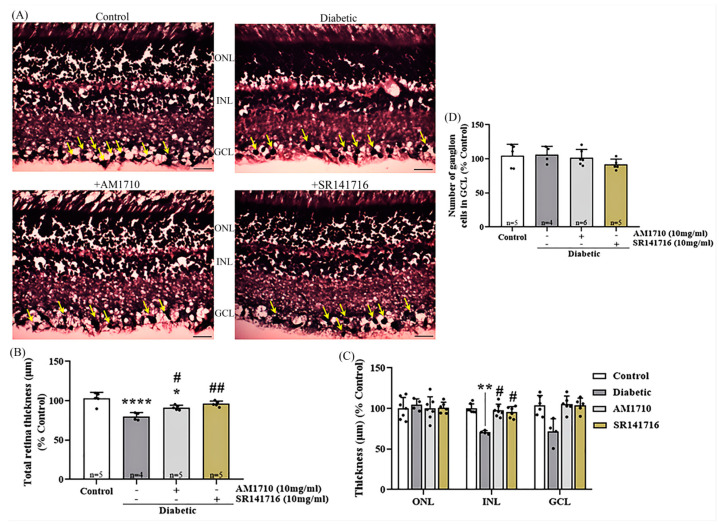 Effect of cannabinoid treatment in the thickness of retinal tissue. (A) Representative photomicrographs of H & E stained retinal tissue). Ganglion cells (black) are depicted with yellow arrows. Magnification 20×. Scalebar: 50 μm. (B) Quantification analysis of the whole retinal tissue thickness, measured from the retinal pigment epithelium (RPE) to the ganglion cell layer (GCL). Diabetes induced a significant reduction in the total thickness of the retina (**** p < 0.0001 compared to Control). Administration of AM1710 partially blocked the reduction in the thickness of the diabetic retina (* p = 0.0161 compared to Control, # p = 0.0271 compared to diabetic untreated). SR141716 displayed similar actions (p > 0.05 compared to Control, ## p = 0.0019 compared to diabetic untreated). (C) Quantitative analysis of the thickness of three separate nuclear retinal layers, outer nuclear layer (ONL), inner nuclear layer (INL), and GCL. Diabetes had no effect on the thickness of ONL (p > 0.05 compared to Control). INL: The thickness of INL in the diabetic retinas was significantly thinner compared to the retina of Control animals ** p = 0.0034 compared to Control). Treatment with either the CB2R agonist (AM1710; # p = 0.0244 compared to Diabetic untreated, p > 0.05 compared to Control) or CB1R antagonist (SR141716; # p = 0.0383 compared to diabetic untreated, p > 0.05 compared to Control), reversed this reduction of thickness. GCL: The thickness of GCL remained unaffected by diabetes (p > 0.05 compared to Control). (D) Quantitative analysis of the ganglion cell population in GCL. The number of ganglion cells in GCL remains unaltered by diabetes (p > 0.05 compared to Control). Data are expressed as mean ± S.D and presented in a form that combines a bar diagram and scatter dot plot, with every dot representing a different value. One-way ANOVA was employed for the statistical analysis of data on panels (B,D), followed by Tukey’s multiple comparison test. Two-way ANOVA was employed for the analysis of separate layers’ thickness on panel (C), followed by Sidak’s multiple comparison test. Differences were considered statistically significant when p < 0.05.