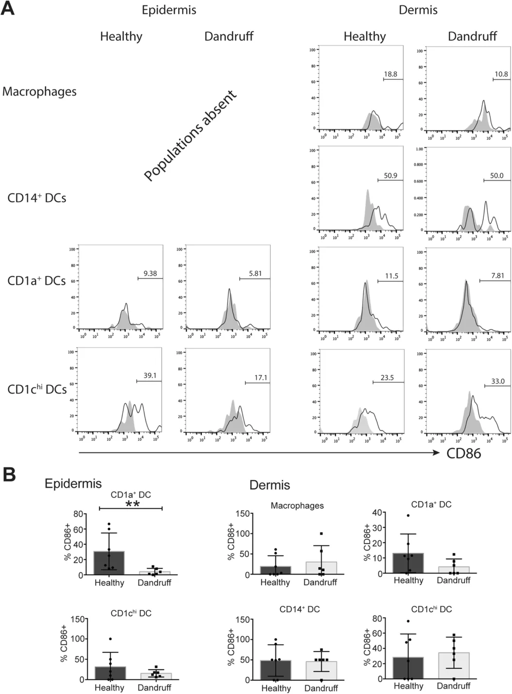 Epidermal CD1a+ dendritic cells express lower levels of CD86 in dandruff. Cells were isolated from scalp skin punch biopsies by enzymatic digestion, and expression of the co‐stimulatory molecule CD86 on antigen‐presenting cell populations was analysed by flow cytometry (representative flow cytometry plots for each cell population shown in panel A). The proportion of CD86‐positive cells differed in the epidermis but not the dermis (B). n = 7 (healthy) or 6 (dandruff), **p < 0.01.