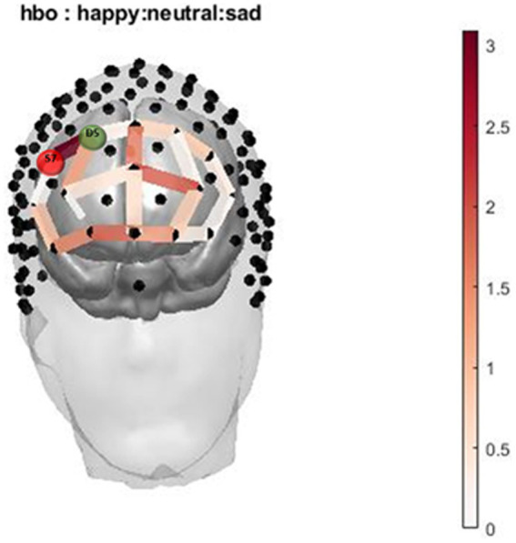 Infant Picture HbO activation. Oxygenated hemoglobin (HbO) levels of activation measured by F state size between groups in relation to location on the prefrontal montage for happy, neutral, and sad faces.