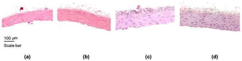 Representative images of aorta sections stained with hematoxylin-eosin. (a) control or healthy rat, (b) ZnONPs-One month treated rat, (c) ZnONPs-Two months treated rat, and (d) ZnONPs-Three months treated rat. All images were acquired with 10× magnification.