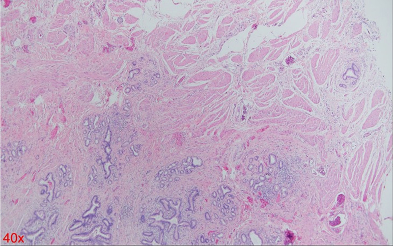 H&E histology (40×). H&E = Hematoxylin and Eosin.