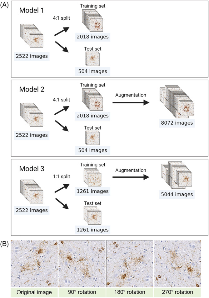 Data augmentation. (A) Flowchart of data augmentation. In Model 1, a total of 2522 images are split into training and test sets at 4:1 ratio. Data augmentation is applied to 2018 images in training set, and the number of images increases to 8072 images. In Model 2, the 2522 images are split into two sets at 1:1 ratio. Data augmentation is applied to 1261 images in training set, and the number of images increases to 5044 images. (B) Representative images of data augmentation. Images are rotated 90°, 180° and 270°