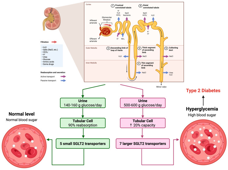 Schematic of SGLT2-mediated glucose reabsorption. Schematic representation of glucose reabsorption in the renal proximal tubule via SGLT2 under normoglycemic (left) and hyperglycemic diabetic (right) conditions, illustrating upregulation of transporter activity in T2DM.